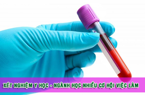 Cơ hội việc làm khi học Trung cấp Kỹ thuật Xét nghiệm TPHCM.