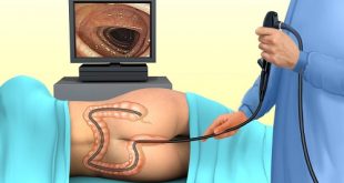 Kỹ thuật Xét nghiệm Y học giúp phát hiện sớm bệnh viêm đại tràng