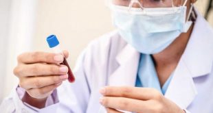 xét nghiệm PCR