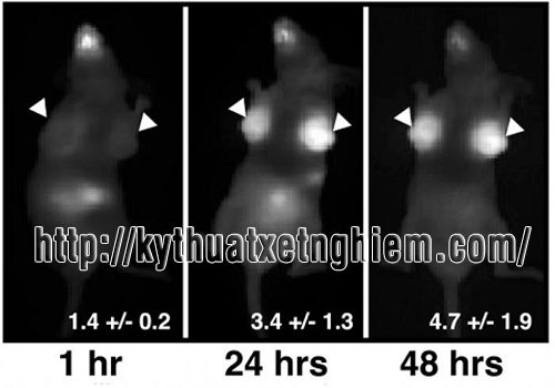 thuoc-phat-sang-phat-hien-som-ung-thu