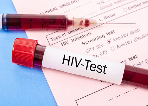 Các phương pháp xét nghiệm HIV qua mẫu máu phổ biến