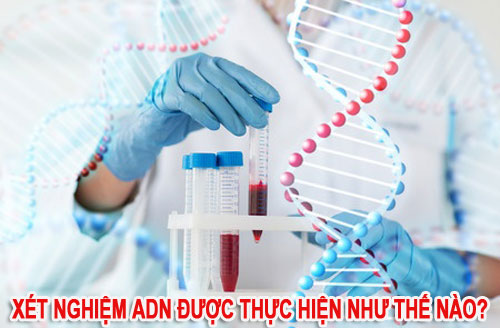 Xét nghiệm ADN xác minh huyết thống như thế nào?