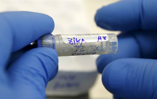 Làm xét nghiệm chẩn đoán virus Zika ở đâu chính xác - 2