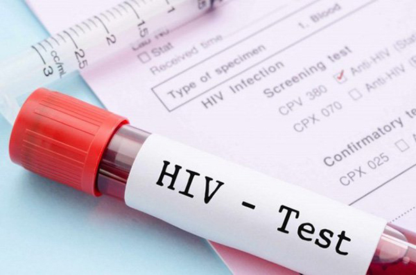 Xét nghiệm HIV chính xác nhất sẽ phụ thuộc vào loại xét nghiệm và thời điểm sau tiềp xúc với nguy cơ.