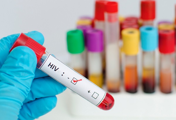 Nếu bạn có nguy cơ tiếp xúc với HIV, hãy nhớ thực hiện xét nghiệm định kỳ.