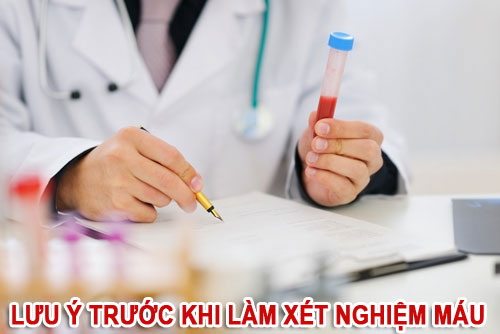 Những điều cần lưu ý khi làm xét nghiệm máu