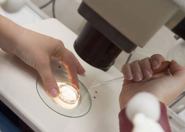 Kết quả xét nghiệm tinh dịch cho biết hình dạng, kích thước, số lượng tinh trùng